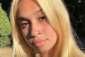 La joven perdió su pelo por el mal uso de un producto.