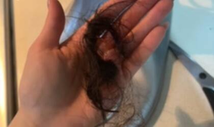 La joven perdió una gran cantidad de pelo (Foto: @natalia.sarahii)