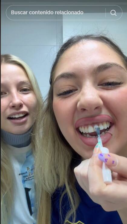La joven se puso esmalte de uñas en los dientes para “blanquearlos” (Captura: TikTok)