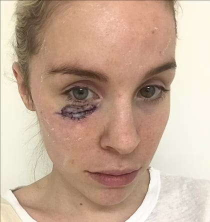 La joven se sometió a una cirugía para que le extirpen el tumor (Foto: Gentileza Daily Mail)
