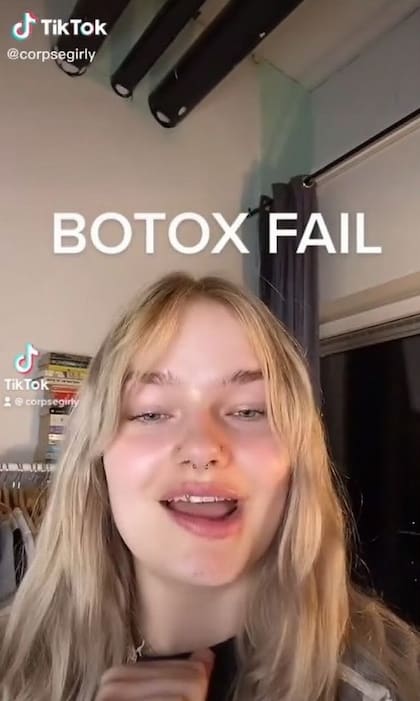 La joven trató de describir en el video los efectos del botox (Crédito: TikTok)