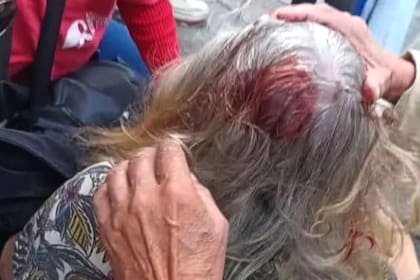 La jubilada cayó hacia atrás impactando su nuca contra el suelo producto del altercado con el policía