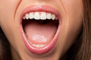 Estas son las razones de por qué salen ampollas o puntos rojos en la lengua
