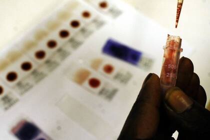 Las muestras de sangre para la malaria se deben controlar regularmente para revisar la resistencia a los medicamentos