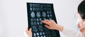 Expertos explican cómo el cerebro puede engañarnos a través de los recuerdos