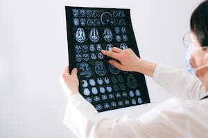 Expertos explican cómo el cerebro puede engañarnos a través de los recuerdos