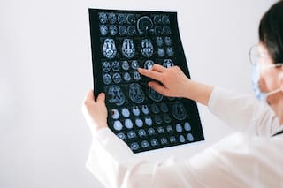 Expertos explican cómo el cerebro puede engañarnos a través de los recuerdos