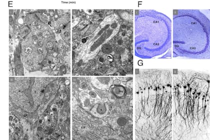 La microscopía electrónica reveló una ultraestructura bien conservada en la región CA1 del hipocampo postvitrificación