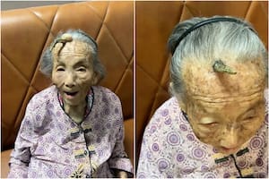 La mujer de China se mostró con una extraña protuberancia en su frente