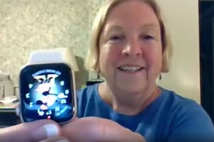 La mujer descubrió que tenía un tumor gracias a su Apple Watch