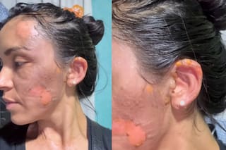 Atacaron con agua hirviendo a una mujer durante un partido de hockey infantil