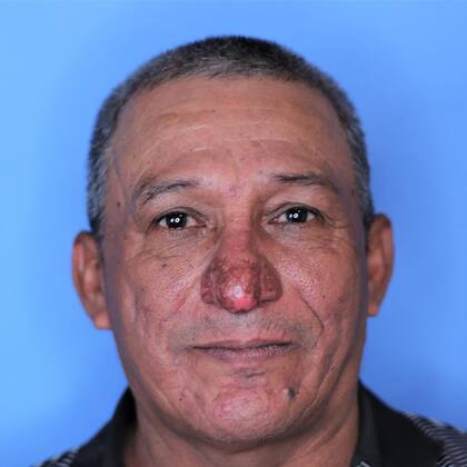 La nariz del hombre llegaba cerca de sus labios, algo que le dificultaba comer