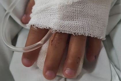 La niña sufrió heridas tras tirarse del auto