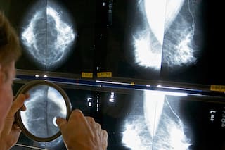 La pandemia de COVID-19 redujo la supervivencia de pacientes con cáncer, según estudio