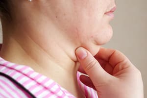 La papada es una de las principales razones detrás de las inseguridades estéticas para muchas personas