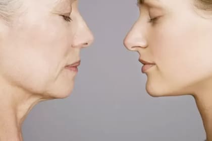 La pérdida de colágeno es un proceso natural del cuerpo: a partir de los 25 años se empieza a registrar una pérdida del 1% de colágeno al año