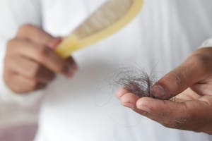 La pérdida del cabello preocupa a millones de personas alrededor del mundo