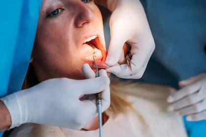 La periodontitis es una afección grave