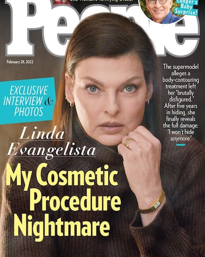 “La pesadilla de mi procedimiento cosmético”, así tituló People la entrevista de Linda Evangelista (Crédito: Instagram/@lindaevangelista)