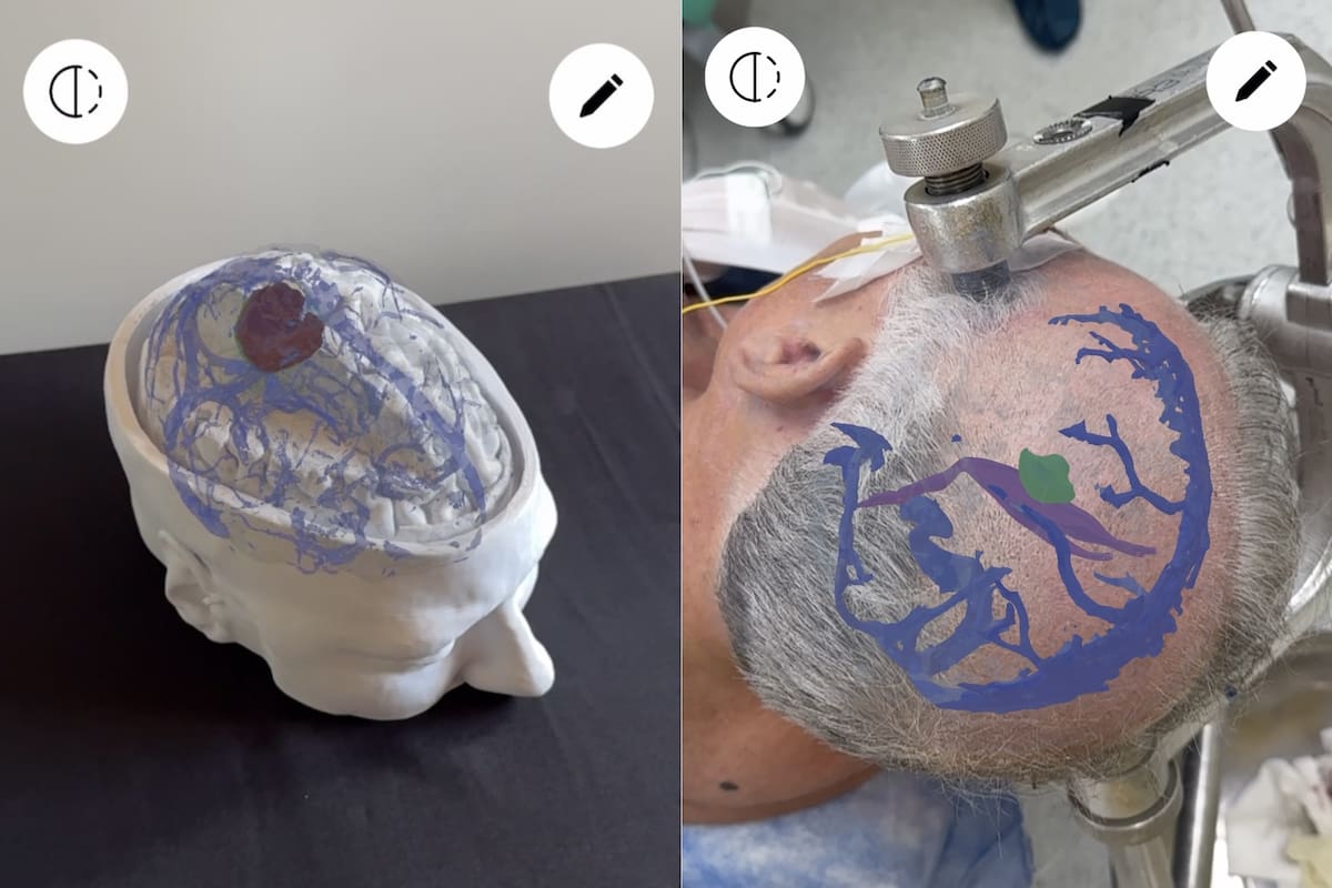 ¡Innovación Argentina en el Quirófano! Startup con IA y Realidad Aumentada Revoluciona la Cirugía