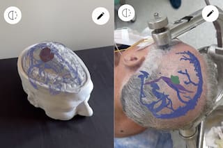 Son argentinos y crearon una herramienta con IA y realidad aumentada para quirófanos