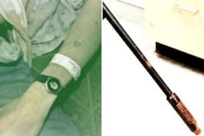 El estudio detectó signos de necrosis cerebral y hepática vinculados a una sobredosis de heroína previa al disparo