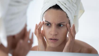 La producción de colágeno se hace notar en la elasticidad de la piel