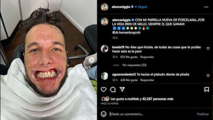 La publicación de Alex Caniggia con sus nuevos dientes