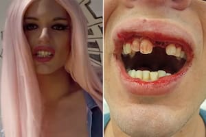 La drag “la Queen” denunció que sufrió un ataque homofóbico en una plaza en Villa Real