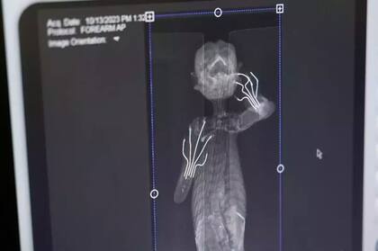 La radiografía de la momia "sirena"