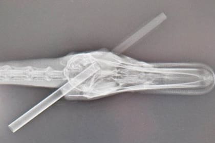 La radiografía tomada sobre el ejemplar herido por el proyectil es impactante