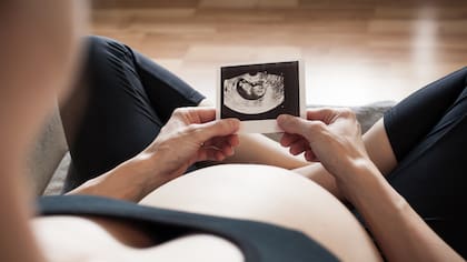 La recomendación es hacer la vitrificación antes de los 30