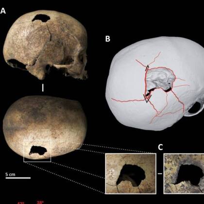 La reconstrucción del homicidio la realizaron científicos catalanes utilizando una lupa binocular y una microtomografía computarizada