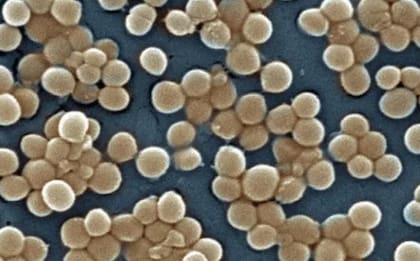 La resistencia a los antibióticos de las bacterias aisladas en las cuevas está ayudando a los investigadores a encontrar nuevos fármacos (Foto: BBC)