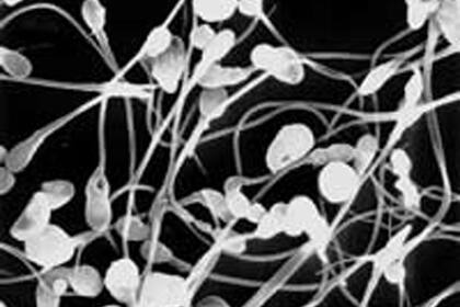 La responsabilidad del donante de esperma en la paternidad es aún un dilema sin resolver