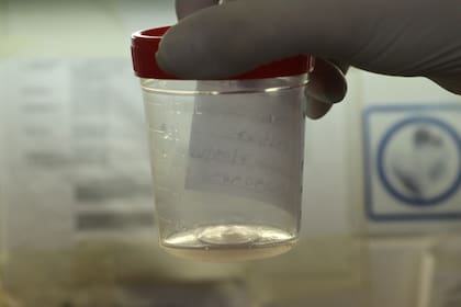 La saliva facilita la toma de la muestra cuando el hisopado no es posible