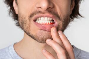 La advertencia de los odontólogos sobre el fuerte impacto de la falta de atención por la crisis