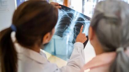 La salud de los pulmones está relacionada con el corazón y la circulación