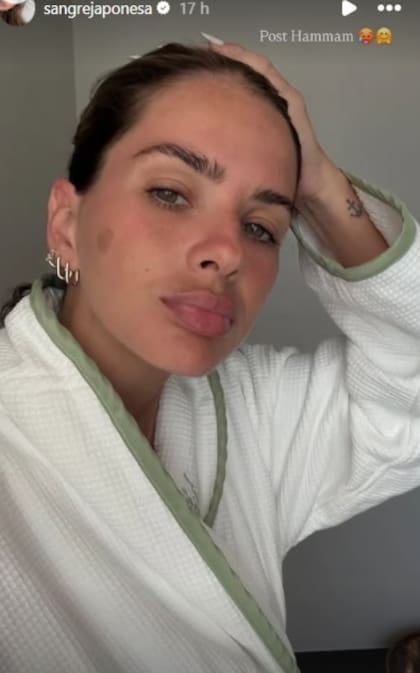 La selfie que publicó la China luego de hacerse el tratamiento (Foto: Instagram @sangrejaponesa)