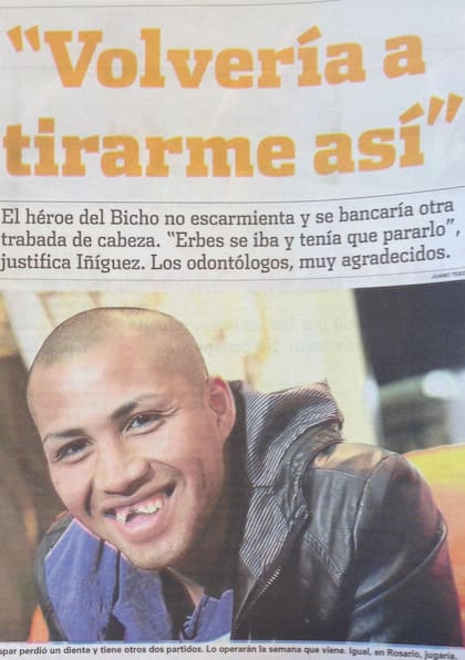 La sonrisa del defensor, pese al duro choque