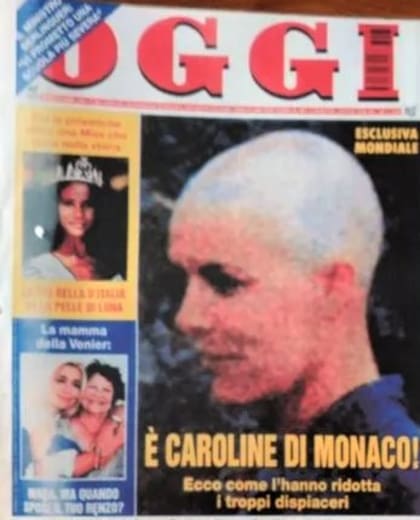 La tapa de la revista italiana OGGI, en 1996, que mostró la primera imagen de Carolina de Mónaco completamente calva.