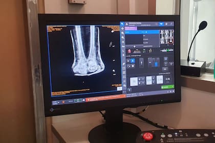 La tecnología actual no permite un estudio profundo de la momia