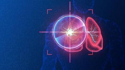 La terapia dirigida actúa sólo en células con mutaciones genéticas específicas