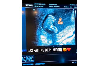 La tierna imagen que compartió la modelo, bailarina y mamá de Donatello