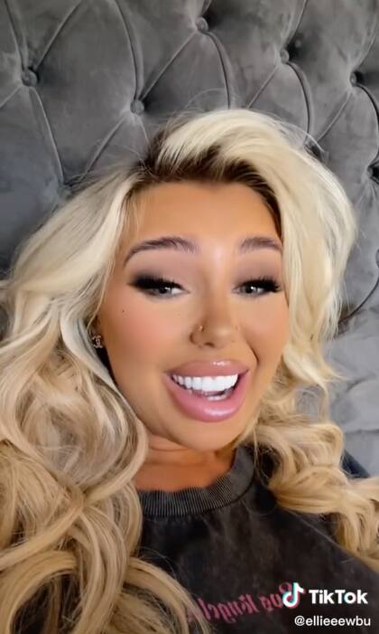 La tiktoker se puso carillas de porcelana