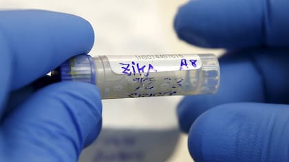 La transmisión sexual del zika no sería una vía muy frecuente