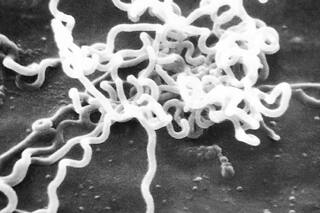 Según el ADN antiguo de un cazador, la bacteria causante de la sífilis estaba en América hace 5500 años