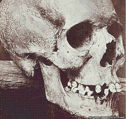 La última vez que se vio el cráneo de Adie fue en una exposición en Glosgow, en 1938
