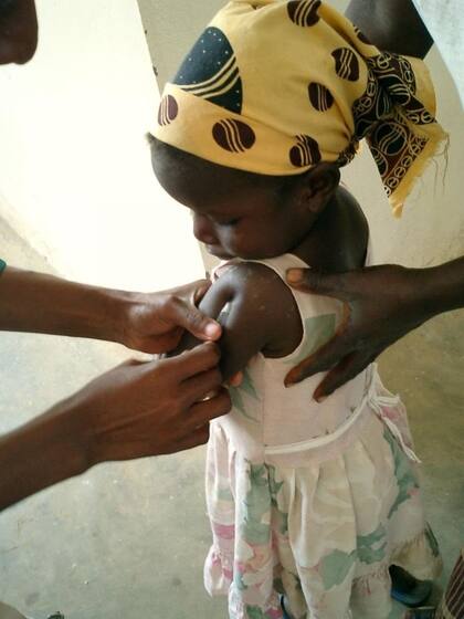 La vacuna Mosquirix se probó en Kenia, Ghana y Malaui