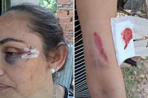 Dos mujeres intentaron matar a la hermana de un intendente de Santa Fe y quedaron detenidas